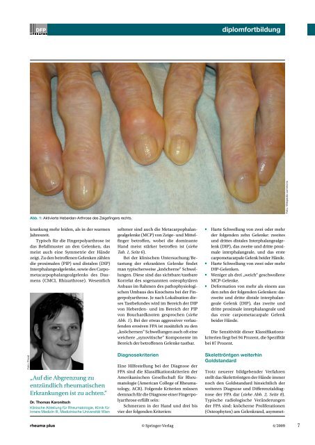 Polyarthrose der Fingergelenke