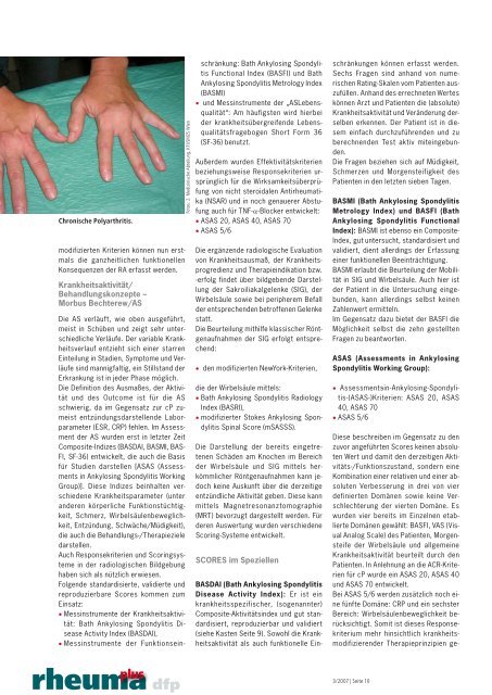 AktivitÃ¤tsscores bei chronischer Polyarthritis und Morbus Bechterew