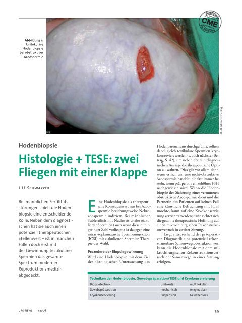 Histologie + TESE - Andrologie-Centrum-Mnchen