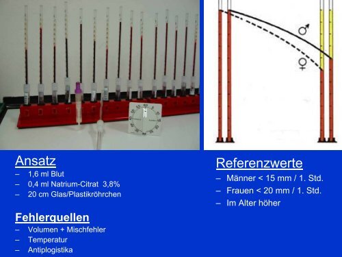 EntzÃ¼ndung-akute Phase-Proteine - Mtaschule-os.de