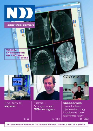 Fra film til skjerm Først i Norge med 3D-røntgen Cocosmile ... - ndd.no