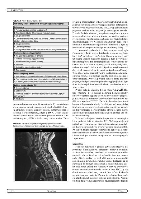 neurologickÃ© prejavy deficitu vitamÃ­nu b12 - kazuistika - snmo.sk