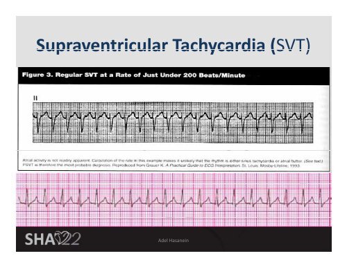 Basic ECG Interpretation - Sha-conferences.com