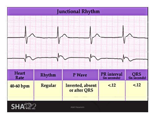 Basic ECG Interpretation - Sha-conferences.com