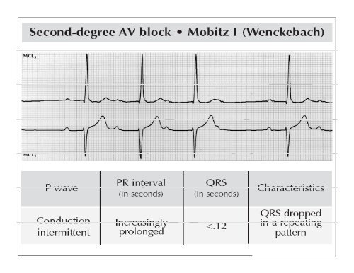 Basic ECG Interpretation - Sha-conferences.com