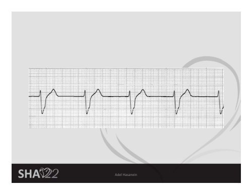 Basic ECG Interpretation - Sha-conferences.com