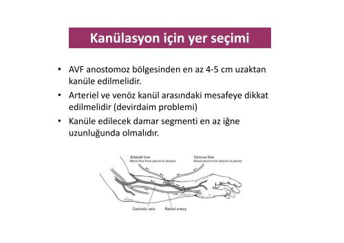 VaskÃ¼ler GiriÅ KullanÄ±mÄ± ve Takip Prensipleri - TÃ¼rk Nefroloji DerneÄi