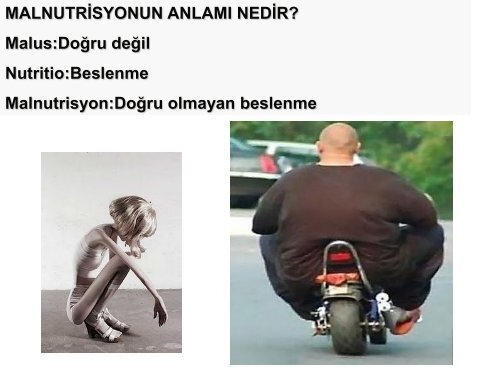 Ä°leri BÃ¶brek YetmezliÄinde Protein Enerji KaybÄ±nÄ±n Ãnlenmesi ve ...