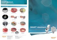 SMART Abutment - Osstem.