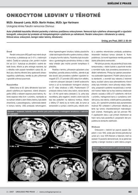 OtevÅÃ­t - Urologie pro praxi