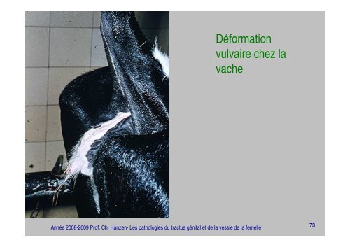 Le Pneumo Vagin Etiol - 