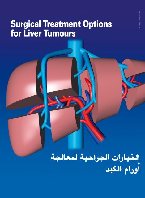 جراحة الكبد - the German Medical Journal