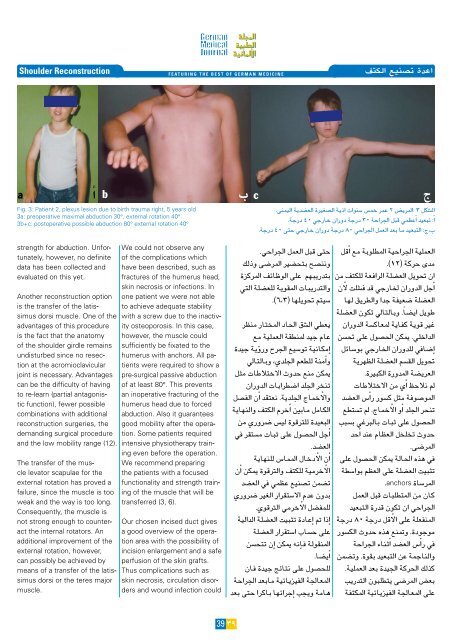 جراحة الكبد - the German Medical Journal