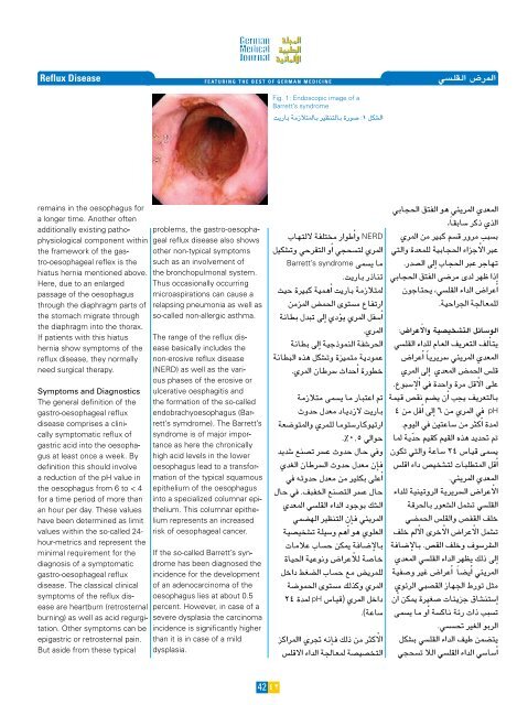 جراحة الكبد - the German Medical Journal