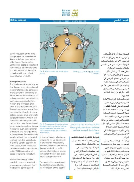 جراحة الكبد - the German Medical Journal