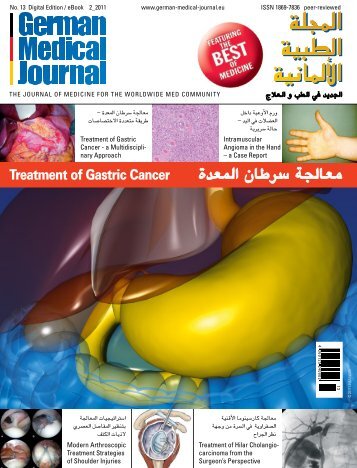 معاجلة رسطان املعدة - the German Medical Journal