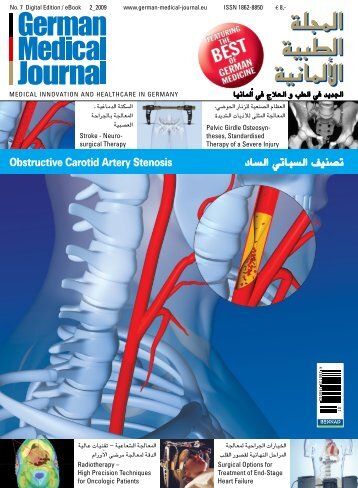 املعاجلة اجلراحية العسبية - the German Medical Journal