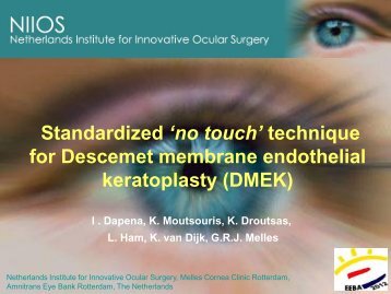 technique for Descemet membrane endothelial keratoplasty (DMEK)