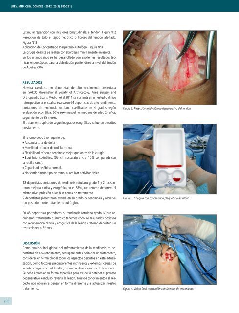 LESIONES TENDINOSAS EN MEDICINA DEL DEPORTE ...