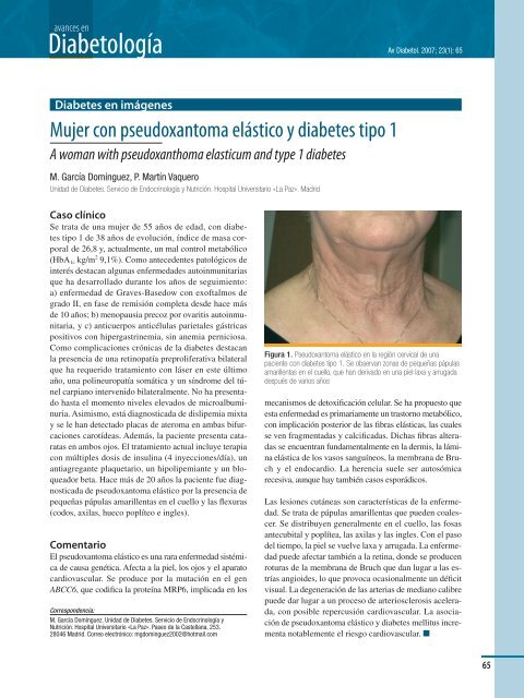 00A PORT Y LOMO AVA.indd - Sociedad EspaÃ±ola de Diabetes