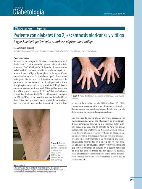 Descargar - Sociedad EspaÃ±ola de Diabetes