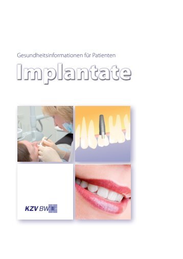 patienteninformation implantate