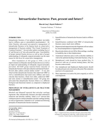 Intraarticular fractures: Past, present and future? - Punjab ...