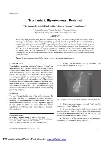 Trochanteric flip osteotomy - Punjab Orthopaedic Association