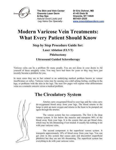 Oneonta Final Exam Schedule Fall 2022 Modern Varicose Vein Treatments - Oneonta Laser Derm