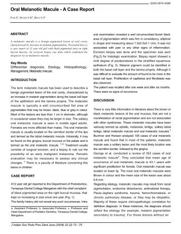 Oral Melanotic Macule - A Case Report - sygdoms