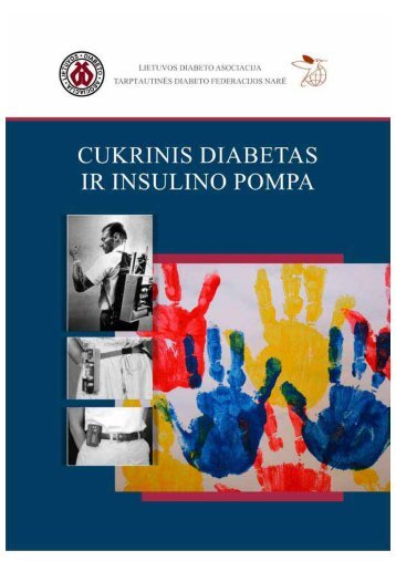 insulino pompa - Lietuvos diabeto asociacija