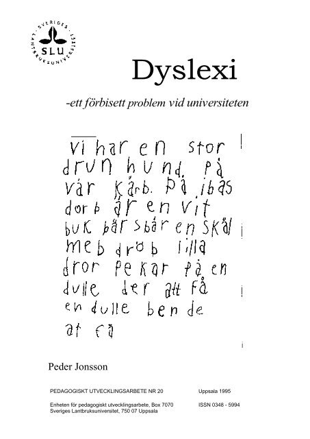 Dyslexi - ett fÃ¶rbisett problem vid universiteten - SLU