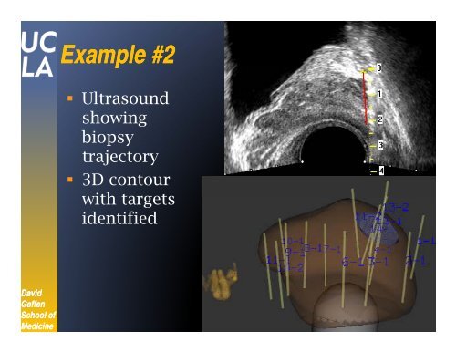 Biopsy Tracking and MRI Fusion to Enhance Imaging of Cancer ...