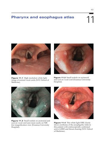 Pharynx and esophagus atlas - GastroHep