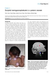 Occipital meningoencephalocele in a preterm ... - BMJ Case Reports