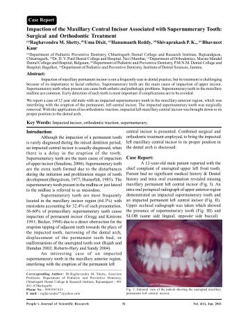 Impaction of the Maxillary Central Incisor Associated - People's ...