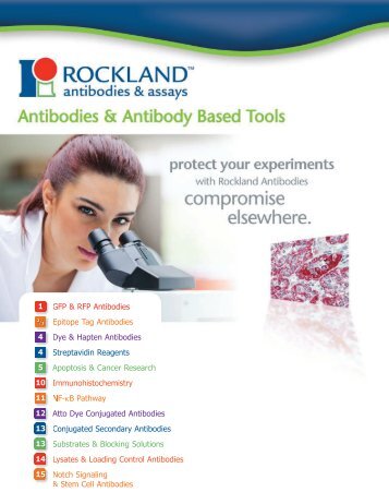 GFP & RFP Antibodies Epitope Tag Antibodies Dye & Hapten ...