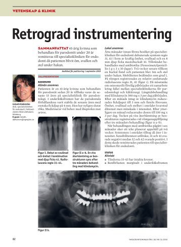 Retrograd instrumentering med filar - Tandläkartidningen