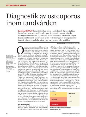 Diagnostik av osteoporos inom tandvården - Tandläkartidningen