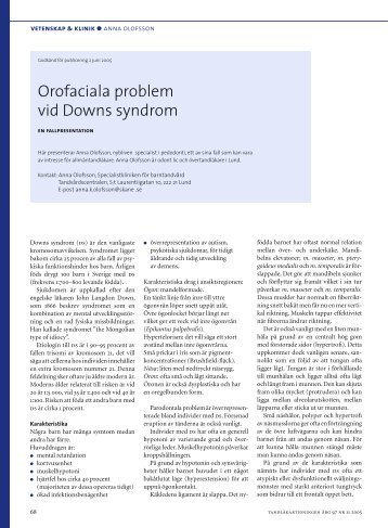 Orofaciala problem vid Downs syndrom