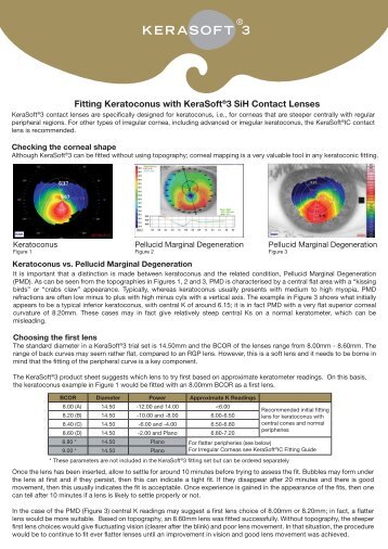 KeraSoft 3 Extended Fitting Guide - UltraVision Group