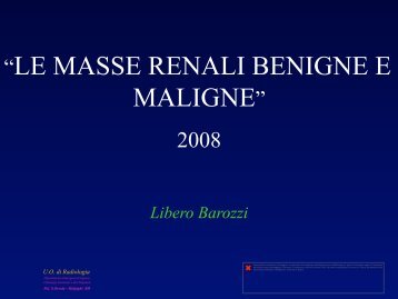 “LE MASSE RENALI BENIGNE E MALIGNE” - siemg