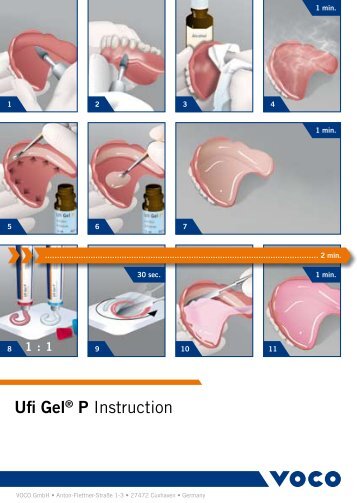 Ufi GelÂ® P Instruction - Voco