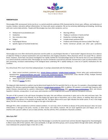 Miller Syncrowave 210 Vs Lincoln Square Wave 200