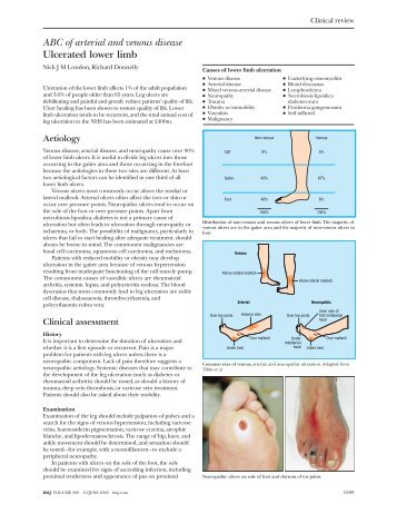 ABC of arterial and venous disease Ulcerated lower limb