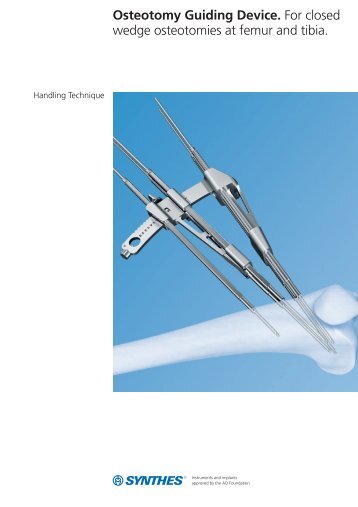 Osteotomy Guiding Device - Synthes