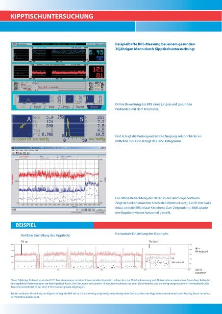 Die Experten fÃ¼r non-invasive Blutdruckmessung und ... - Leuag AG