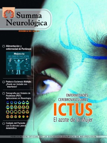 Ictus. El azote de la mujer - Ibanezyplaza.com