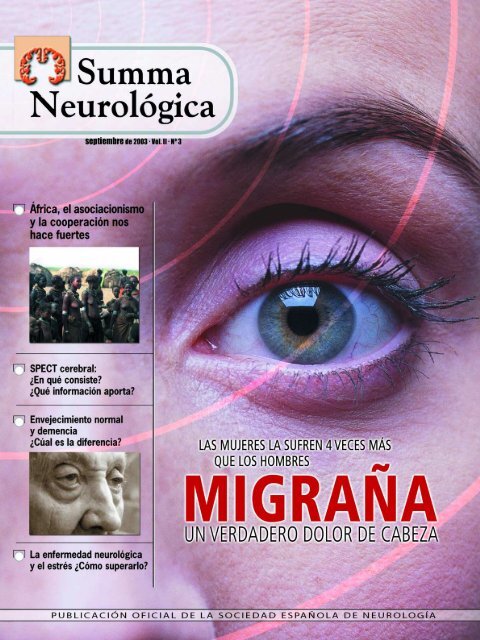 Dolor en el lóbulo frontal significado