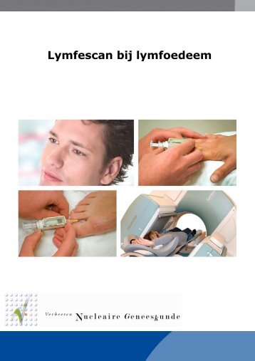 Lymfescan (lymfoedeem) armen of benen - Instituut Verbeeten
